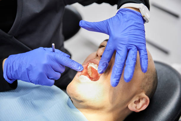Best Emergency Dentist for Lost Fillings or Crowns in West View, PA